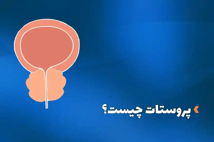 پروستات