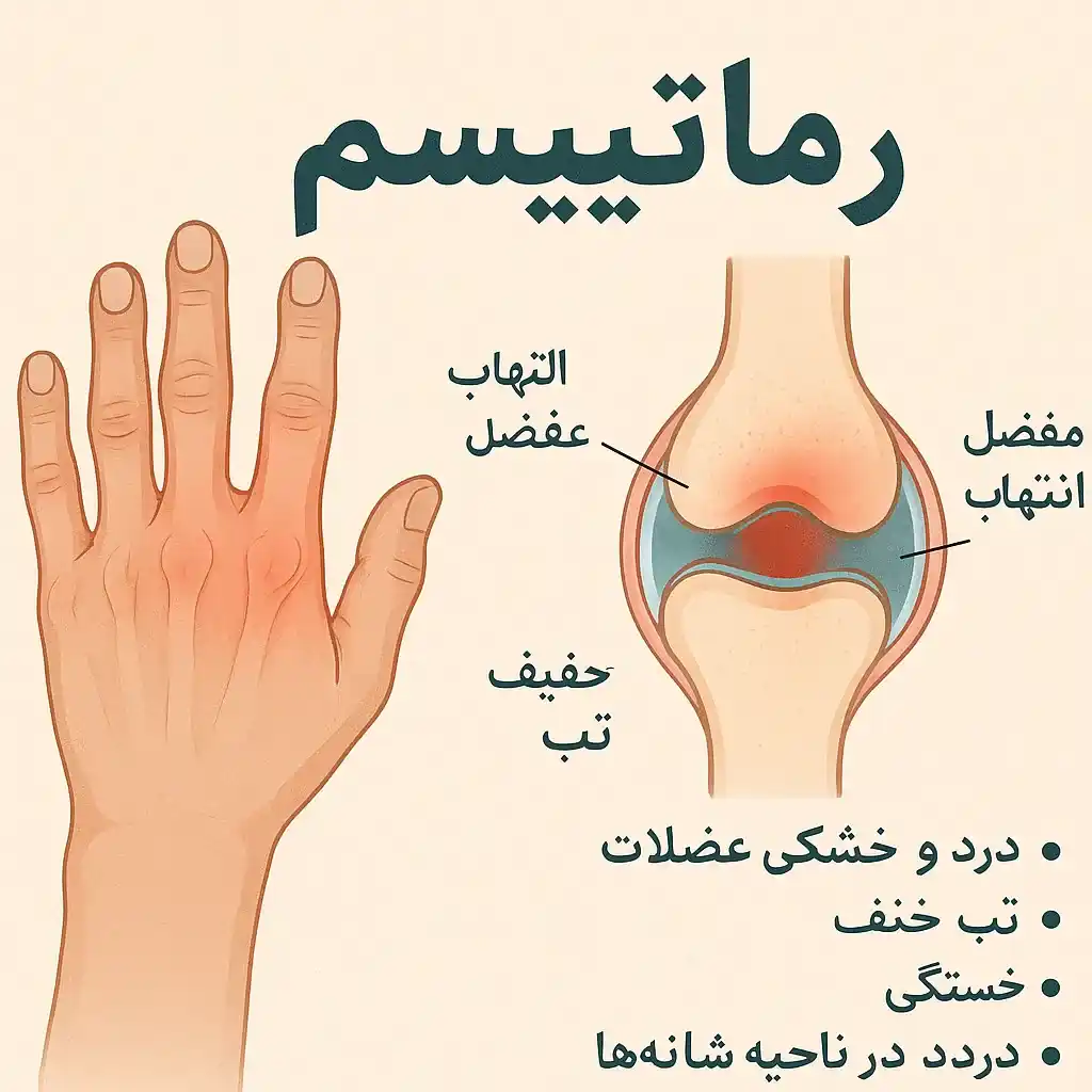 روماتیسم